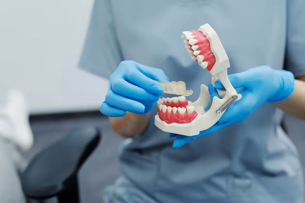 Dental model showing teeth alignment for implant preparation