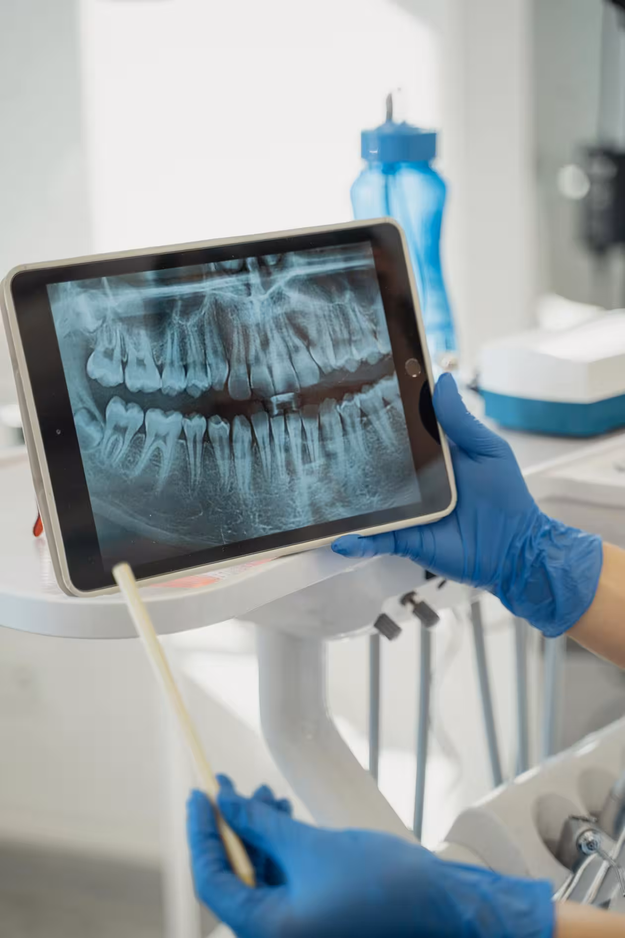 Dental X-ray on screen during root canal diagnosis