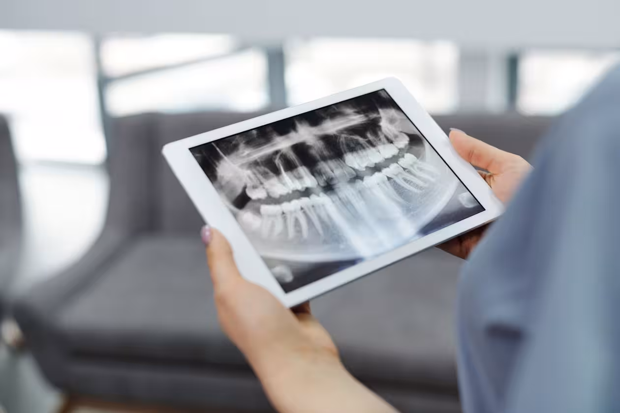 Dental X-ray on tablet showing tooth requiring retreatment