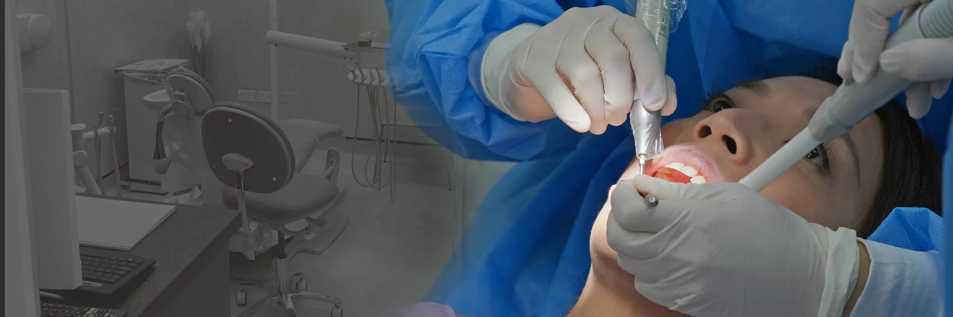 Dental Implant Offer