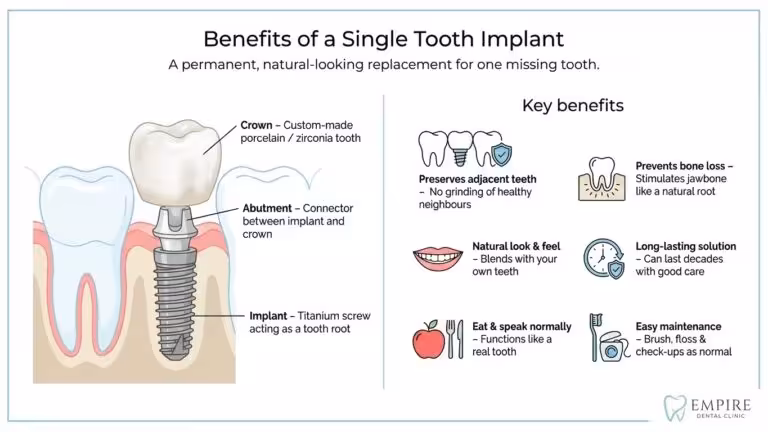 Single Tooth Dental Implant at Empire Clinic Dublin