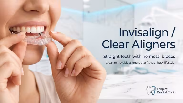 Invisalign / Aligners