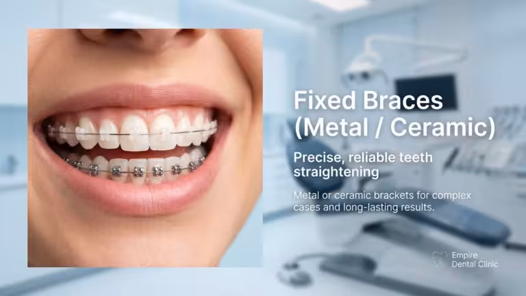 Fixed Braces (metal/ceramic)