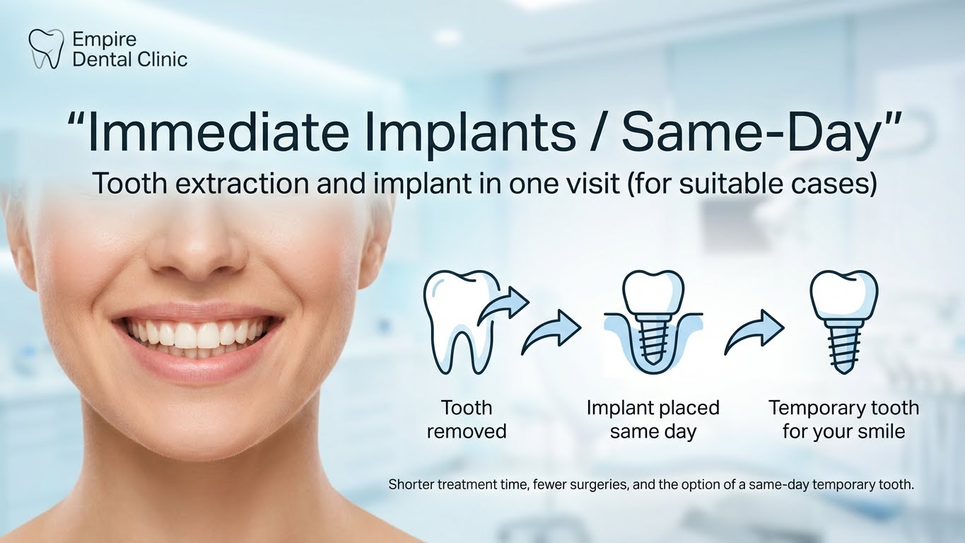 Immediate Implants - Same Day Tooth Replacement