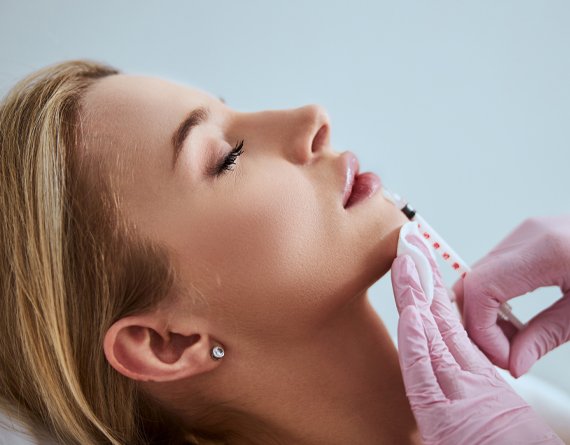 Dermal Fillers Lip Enhancement at Empire Clinic Dublin